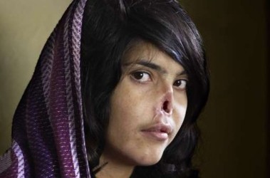 11 лютого 2011, 13:32 Переглядів:   World Press Photo нагородили знімок знівеченої афганської дівчини
