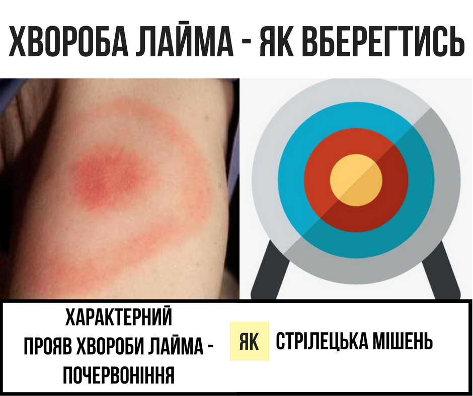 Влітку існує ймовірність натрапити на кліща, який може переносити збудників небезпечних захворювань, одне з них - хвороба Лайма